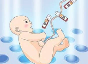 孕期脐带绕颈怎么办，这些知识不能不知