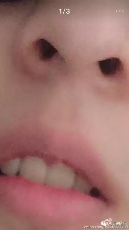 王清媛和刘阳,和王清媛同期的网红