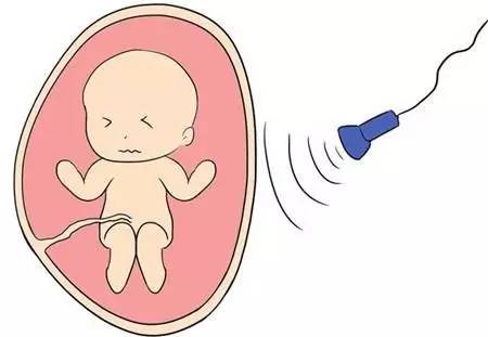 孕妈必备详细清单,孕期35天b超能看出来吗