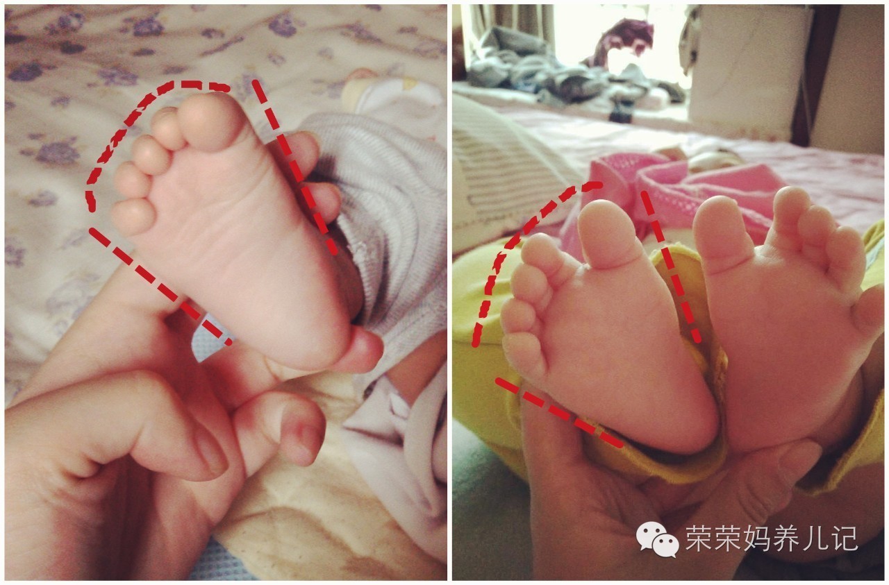 mikihouse获奖鞋是哪款,mikihouse获奖