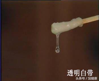 关于女性的健康白带小常识,食疗妙治白带异常