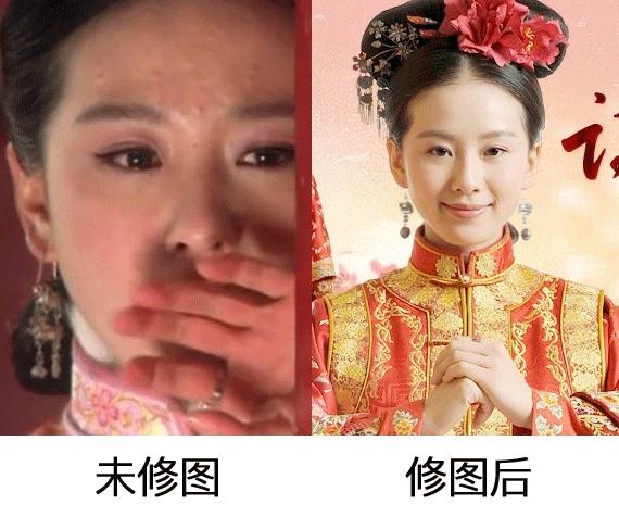 赵丽颖黑头怎么去掉,赵丽颖黑头去除方法