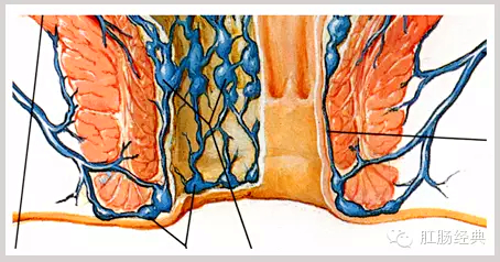 有趣痔疮的知识讲解,怪异的痔疮
