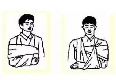 滑雪受伤骨折怎么理赔,滑雪骨折怎么恢复