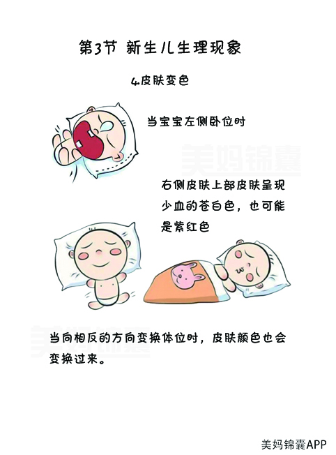 皮肤青紫是什么病,宝宝发烧皮肤青紫怎么回事