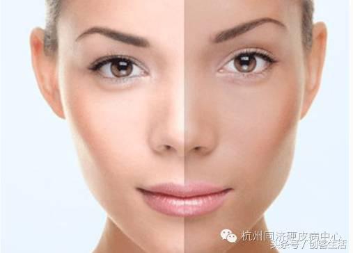 熬夜的下场就是黑眼圈明显出痘痘,为什么熬夜没有黑眼圈和长痘