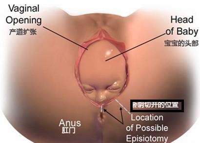 顺产的妈妈大多数会存在这个疑虑,很多妈妈顺产