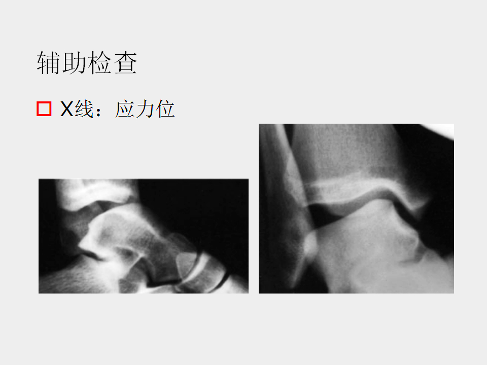 脚崴了怎么办判断是否骨折,脚崴了怎么办视频