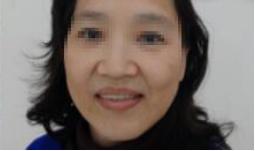 牙齿不齐可以戴隐形牙套吗,牙齿不齐一定要戴钢牙吗