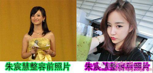 婊曢洦浣虫灄鐝婄強瀵规瘮,婊曢洦浣虫灄鐝婄強瑙嗛