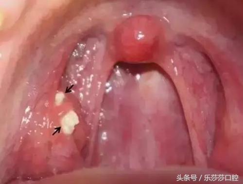 牙医能辨别出换过没换过的牙齿吗,牙医见过最好的牙齿是怎么样的