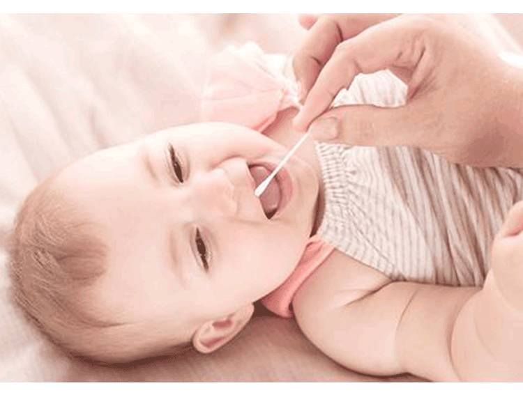 新生儿鹅口疮是什么引发的,新生儿鹅口疮原因