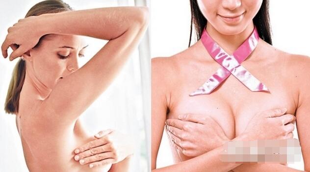 湿疹样乳癌与湿疹的鉴别,怎样判断是不是得了湿疹样乳癌