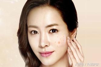 闭合性粉刺怎么去除额头,闭合性粉刺怎么去除