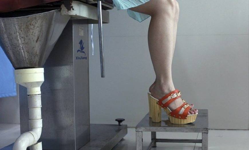 人流术后多久能正常工作,39岁人流术后可以直接上班吗