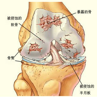 在部队训练膝盖疼痛怎么处理,篮球保护膝盖训练方法