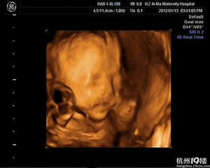 B超单怎么看?B超单正常值对照