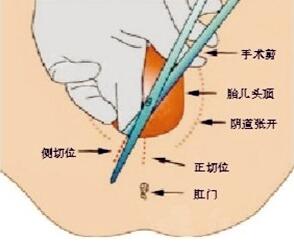 顺产超疼,顺产真疼