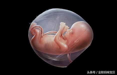 脐带绕颈不要慌,脐带绕颈准妈妈羊水少怎么办