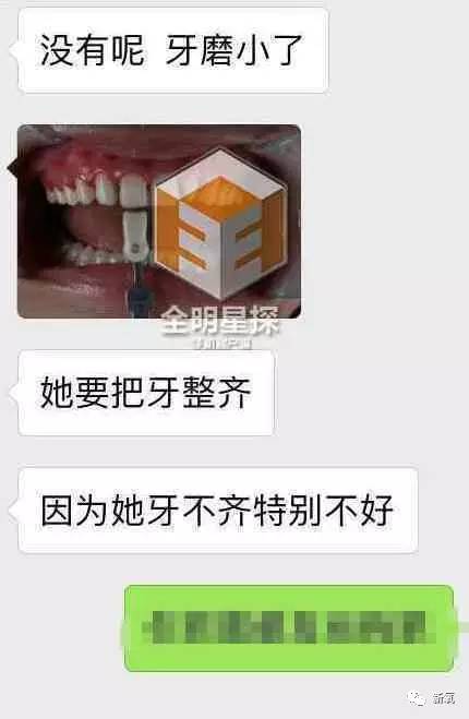 林允整牙却像整容？她是真的又整了啊！