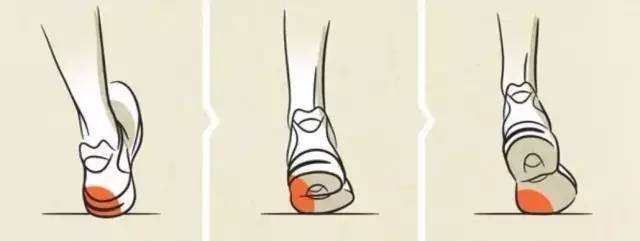 选择跑鞋内翻足和外翻足区别,选鞋不当危害