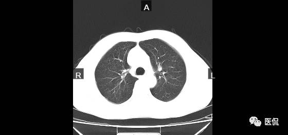 腹部疼痛病例报告,胸外科病例分析报告