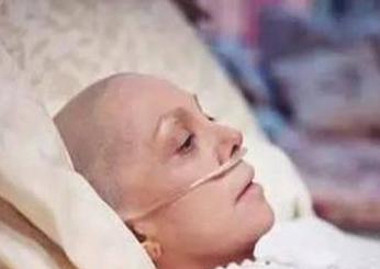 癌症化疗都是怎么化疗的,化疗能减轻癌症晚期患者的痛苦吗