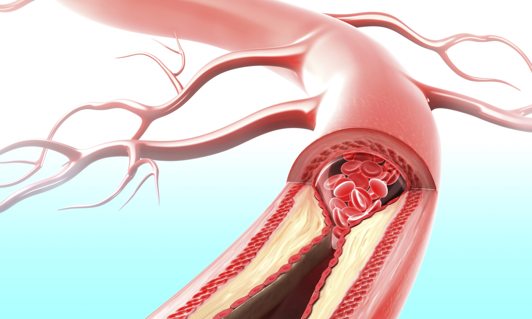 血凝块怎么清洁,怎么保护血凝块不掉