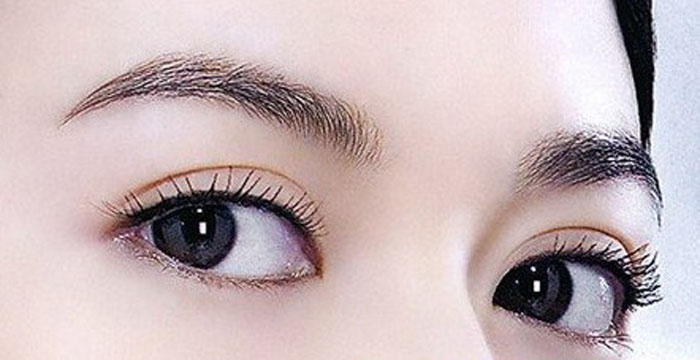 如何使埋线双眼皮快速消肿？