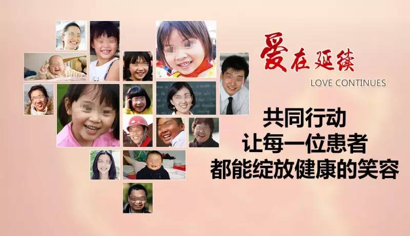 胎记怎样在家治疗,胎记能用中药祛除吗