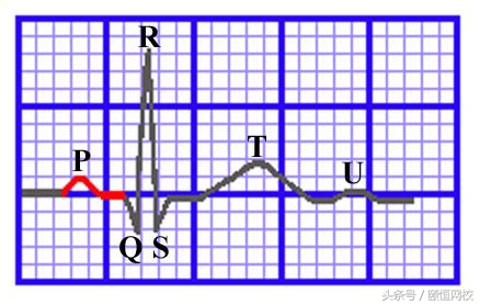 郭雅卿零基础心电图教学口诀,郭老师教你心电图口诀