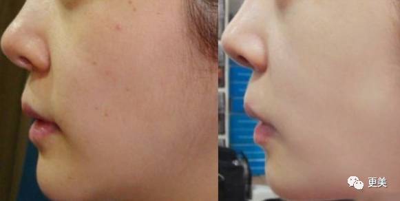 明星卖黑心面膜赚28亿,明星卖面膜