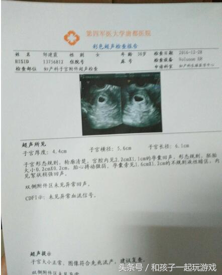 怀孕45天出血怎么判断宫内宫外,孕早期出血多要去挂急诊吗