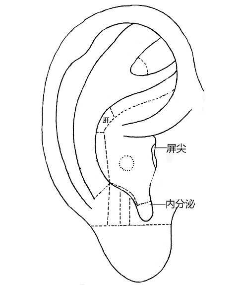 降糖保健操5个动作,糖友甩手保健操