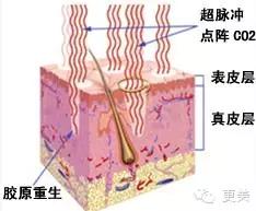 长痘痘好焦虑啊,长痘痘要用什么药治疗