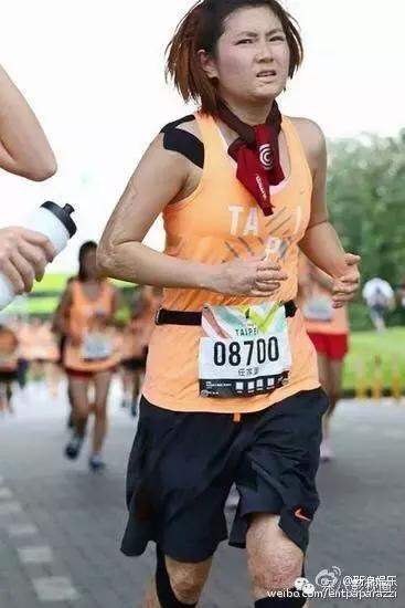 烧伤事件双方粉丝互撕六年，他们承受无尽痛苦，却总是被揭旧伤疤