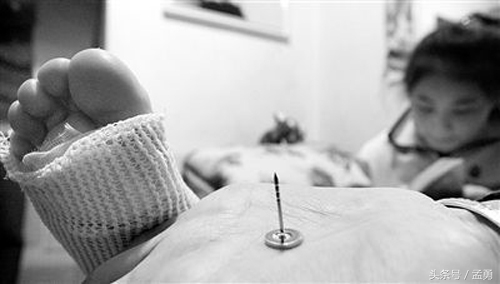 打过百白破受伤还需打破伤风,受伤了多久打破伤风合适