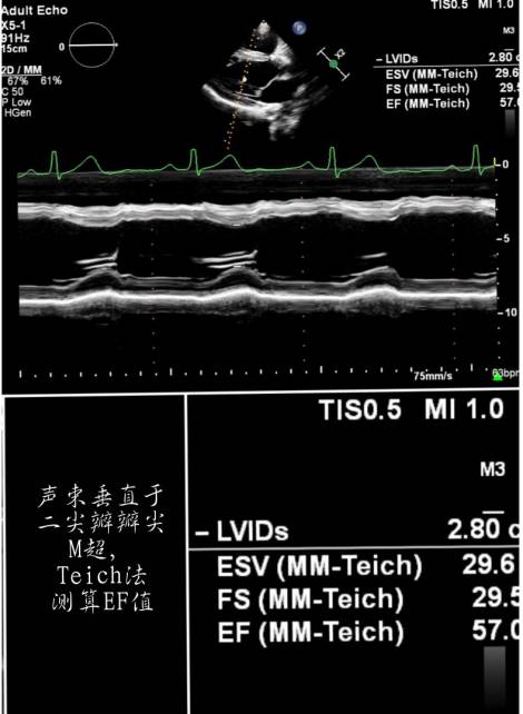 那些年我们错过的歌曲,那些年我们错过的日子