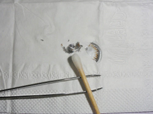 美瞳边缘碎在眼睛里面了,为什么美瞳会在眼睛里碎掉