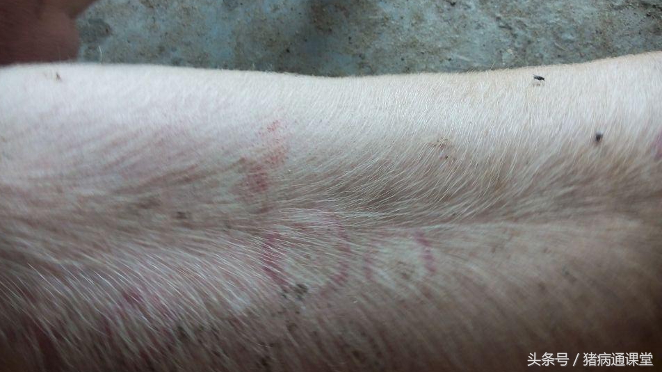 猪玫瑰糠疹打什么针,猪玫瑰糠疹的症状与治疗