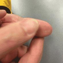 脾胃虚寒气血不足有哪些表现症状,男人气血不足的10个症状怎么调理