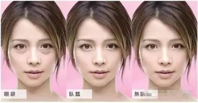 眼袋和卧蚕的区别看完你就知,卧蚕和眼袋的区别你知道吗