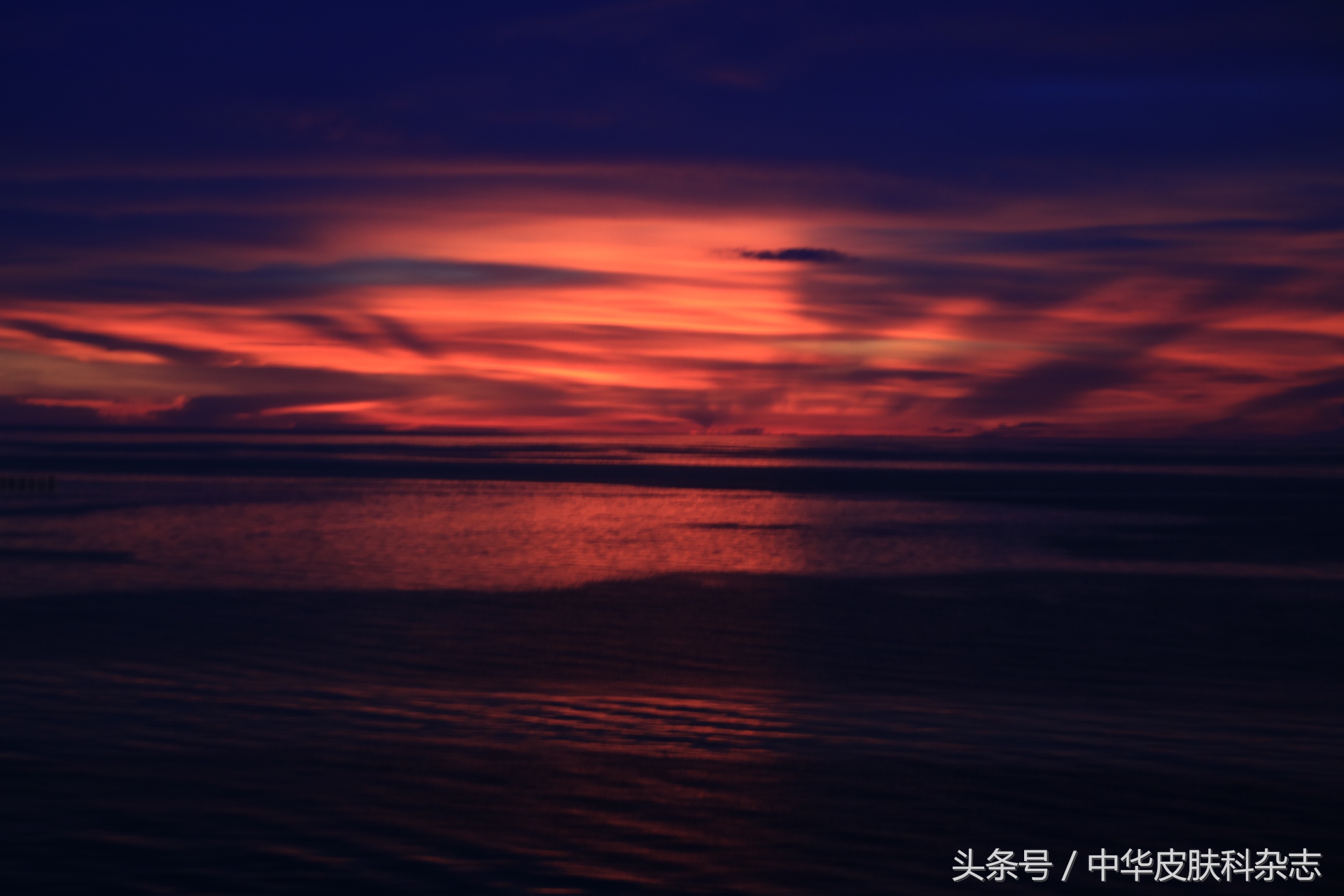 尖锐性湿疣怎么又复发了,尖锐性湿疣避免复发办法