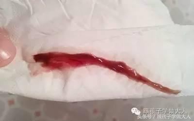 准妈妈做什么检查最好,准妈妈怀孕要做哪些检查