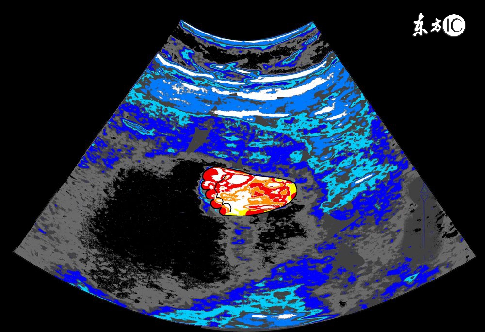 孕妈常规检查不过怎么办,孕妈产检正常就表示宝宝没有缺陷
