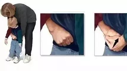 噎住急救法海姆立克单人,噎食的紧急救护方法海姆立克法