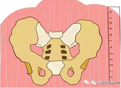 孕期检查结果准确率高吗,孕期查产道怎么查