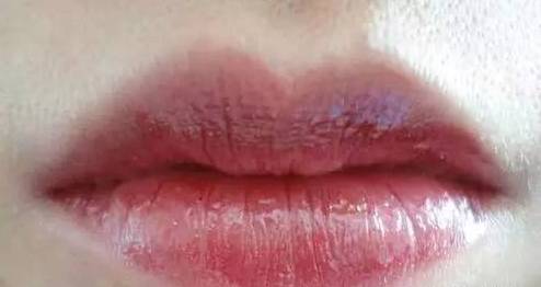 一旦嘴唇变成这种颜色就要警惕,嘴唇发黄要警惕这是一种常见疾病