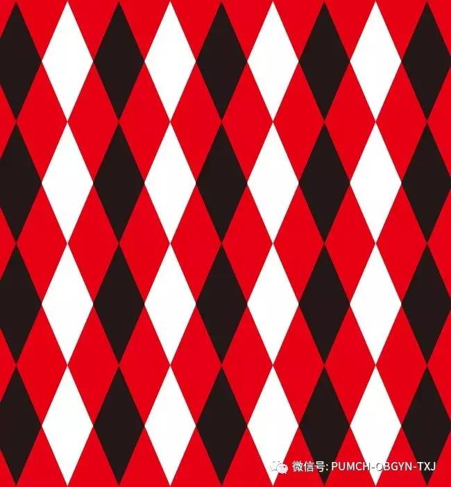 宫颈内膜异位症有哪些症状,子宫内膜异位症三联征