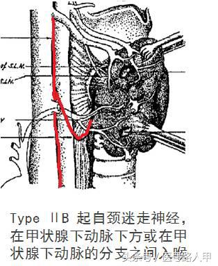 喉返神经的解剖视频,损伤喉上神经和喉返神经的区别